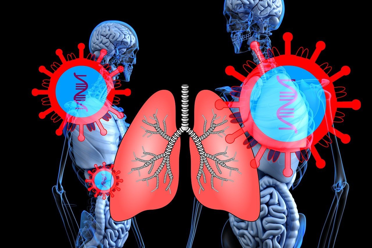 coronavirus, sars-cov-2, lung-4844593.jpg